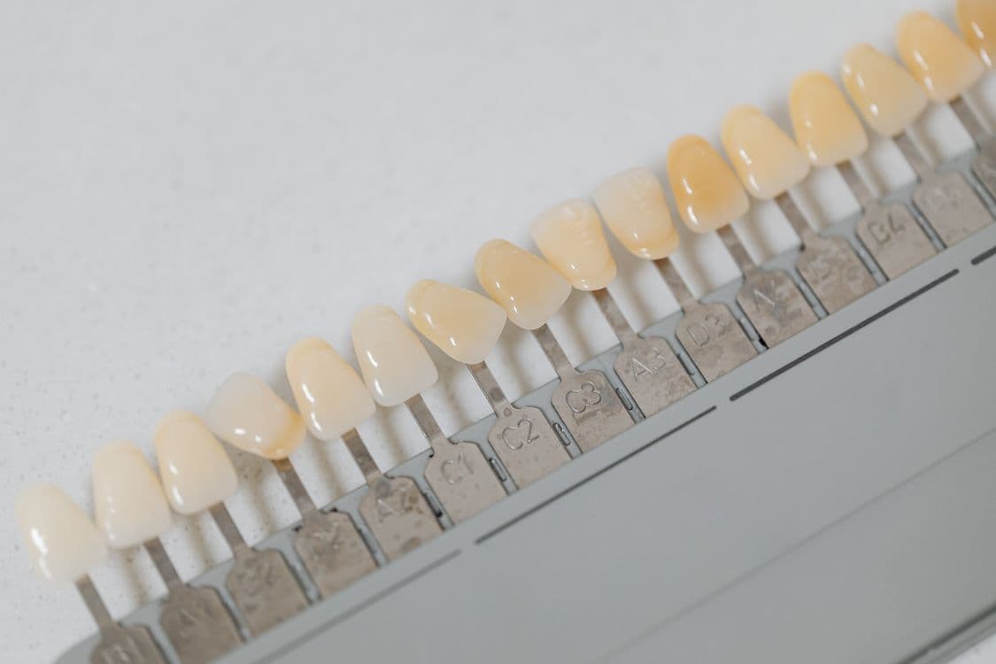 Teeth Whitening in 2026: Professional Treatment vs Home Remedies — What Actually Works