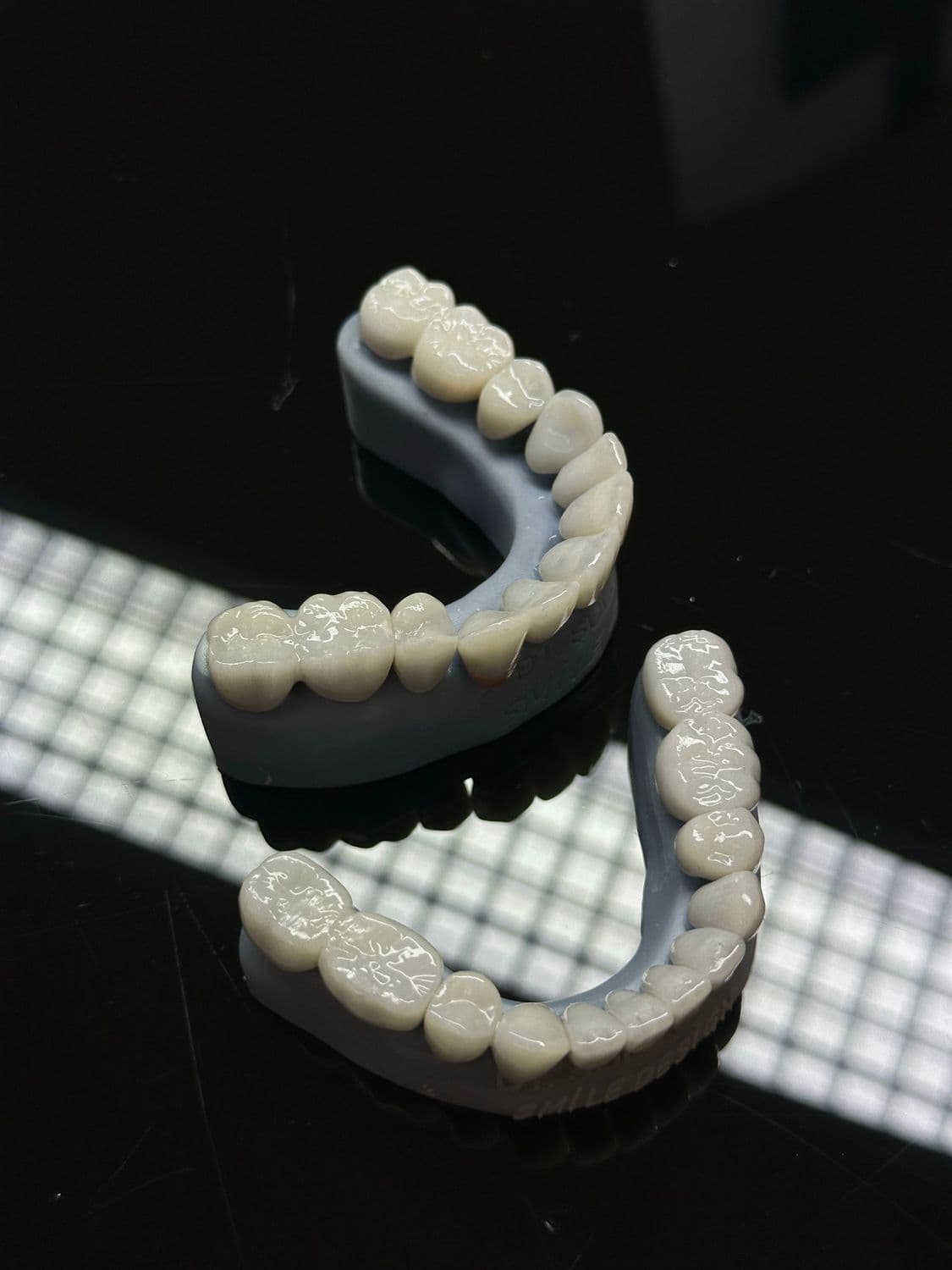 Full Mouth Rehabilitation: Restoring Your Complete Smile with Dental Implants in Vadodara